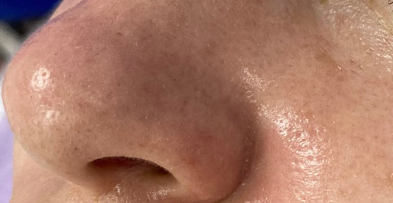 Водородный гидропилинг Hydra Touch H2