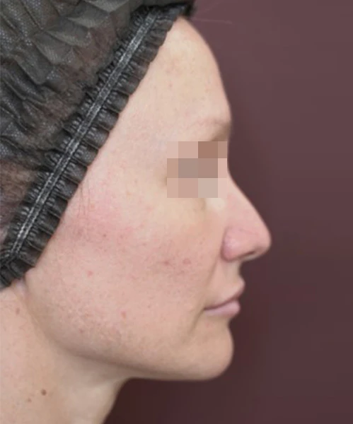 Пациент 3 до процедуры