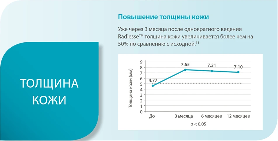 Толщина кожи