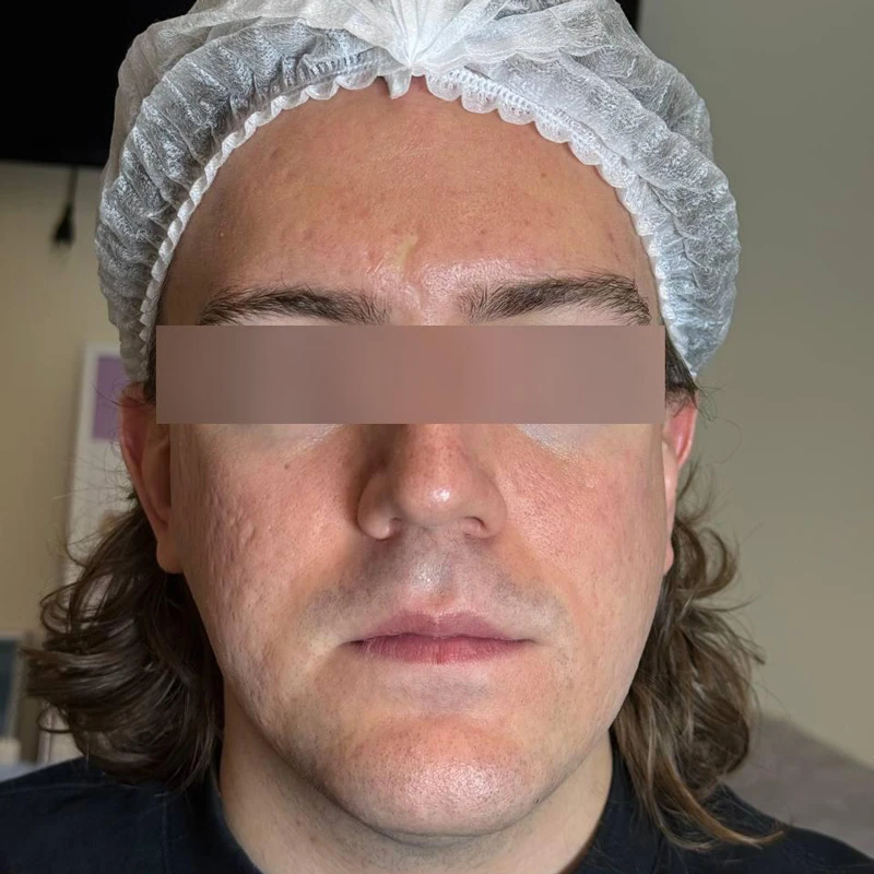 Capello Re:Flex CO₂