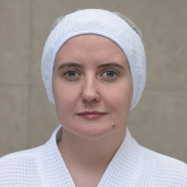 Neauvia Клинический случай