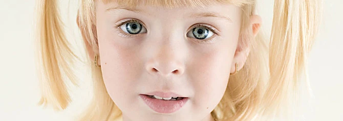 заячья губа фото