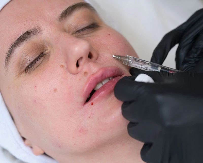 Neauvia Введение