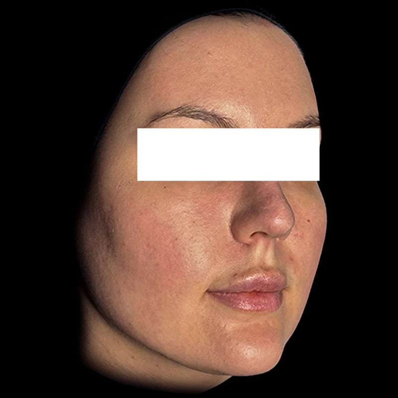 Ultra Skin Solution