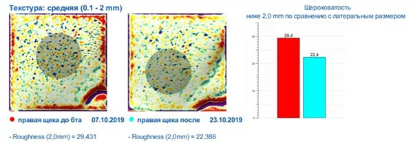 Ксеомин, исследование