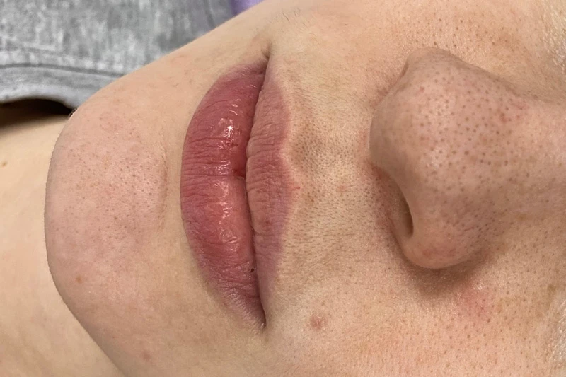 Водородный гидропилинг Hydra Touch H2