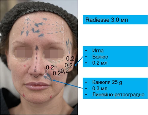 Диагностическая визуализация