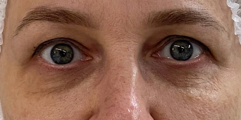 фракционный термолиз на аппарате CAPELLO CO2 Re:Flex, фото до