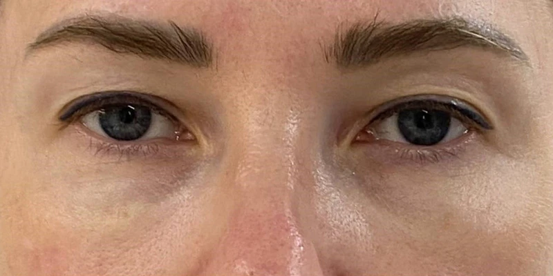 фракционный термолиз на аппарате CAPELLO CO2 Re:Flex, фото до