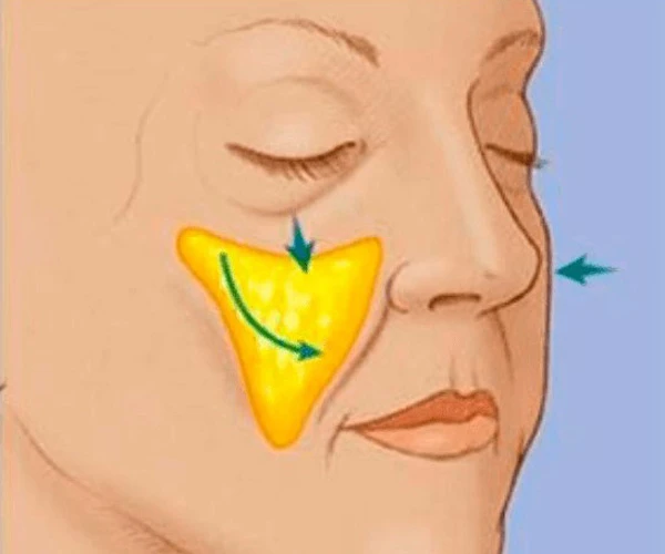 Малярные мешки