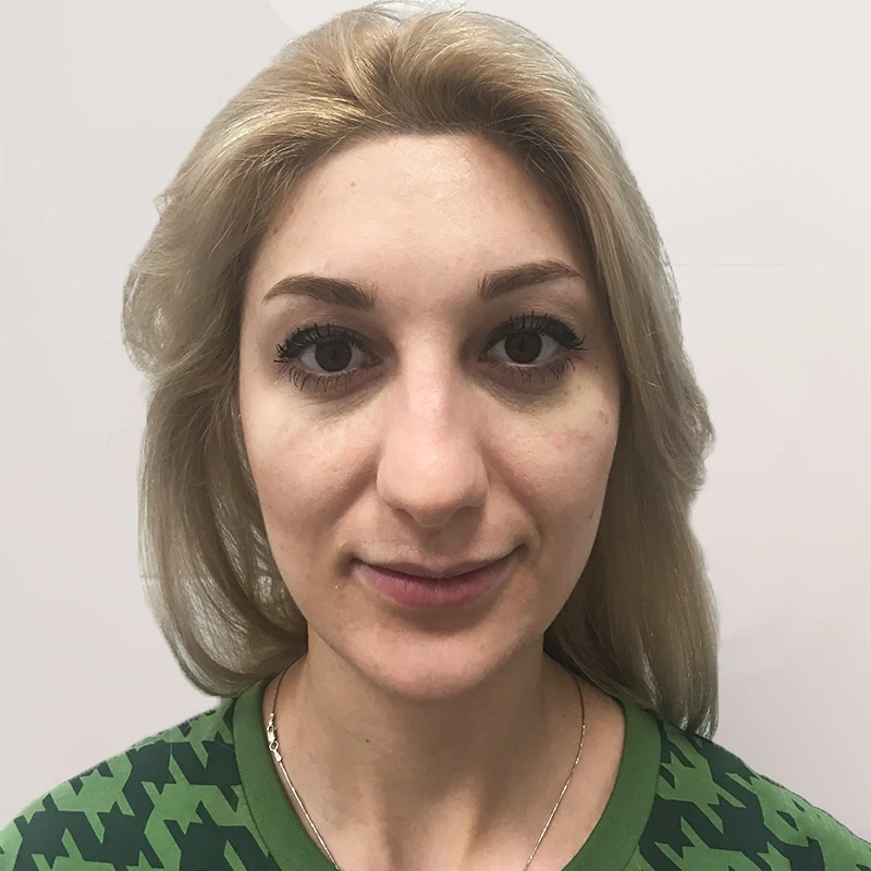 Алла, 32 года. Фото до
