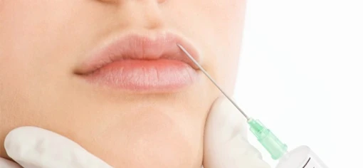 Филлеры для губ