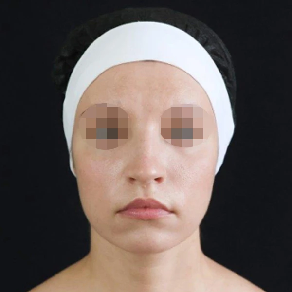 Bioregen
