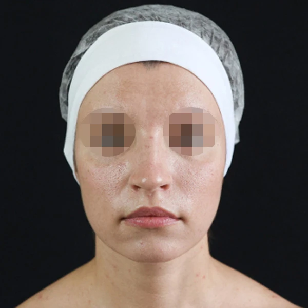 Bioregen