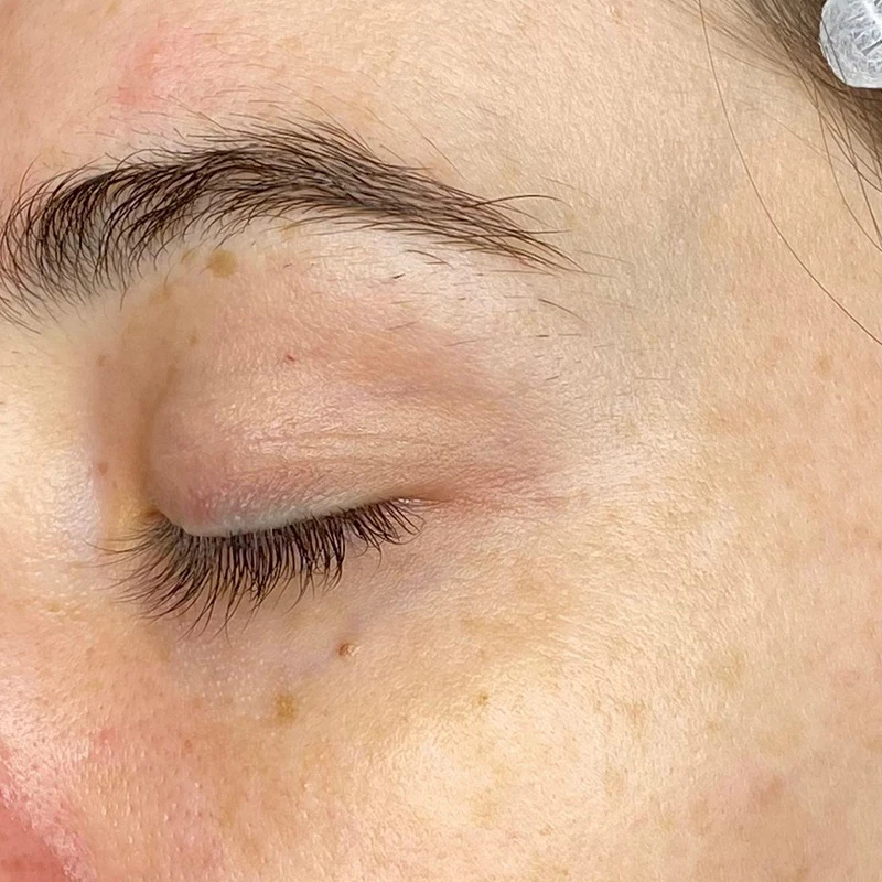 Водородный гидропилинг Hydra Touch H2