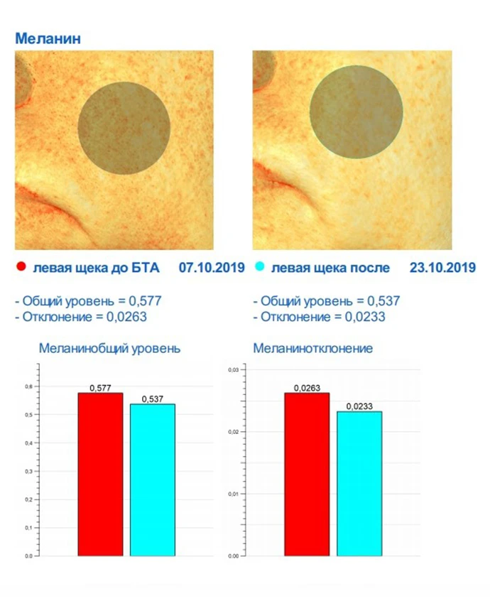Ксеомин, исследование