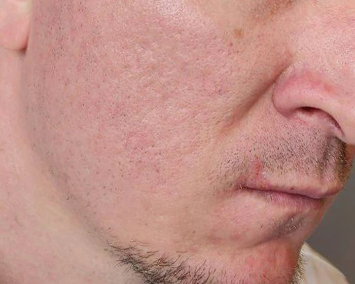 Capello Re:Flex CO₂