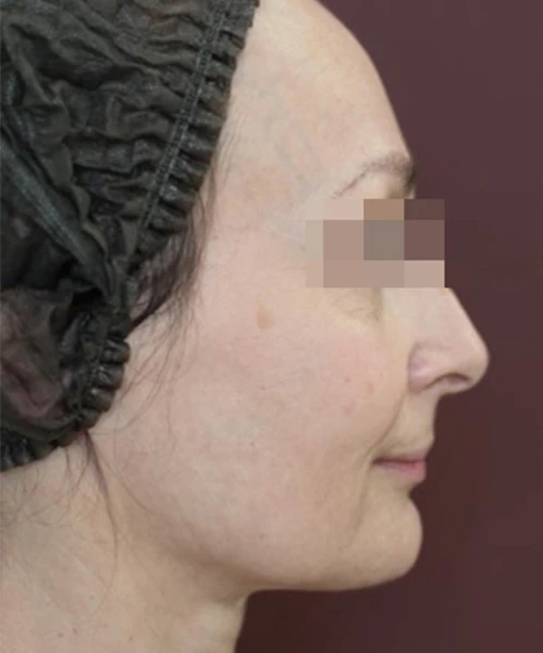 Пациент до процедуры