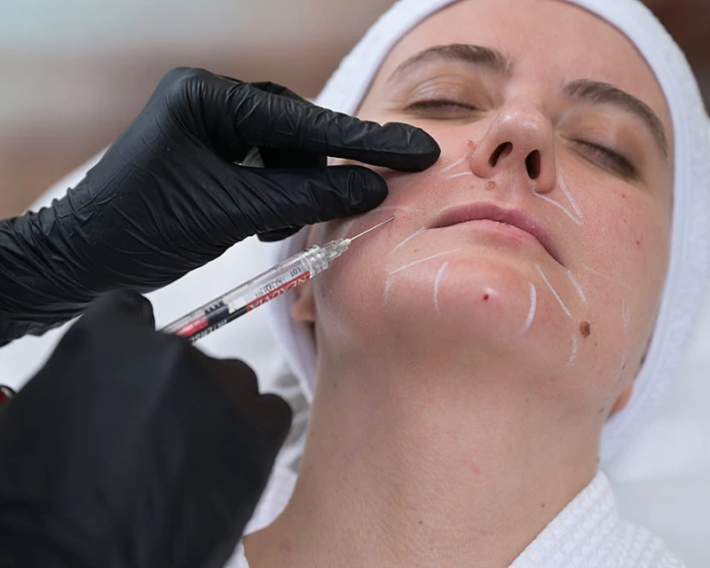 Neauvia Введение