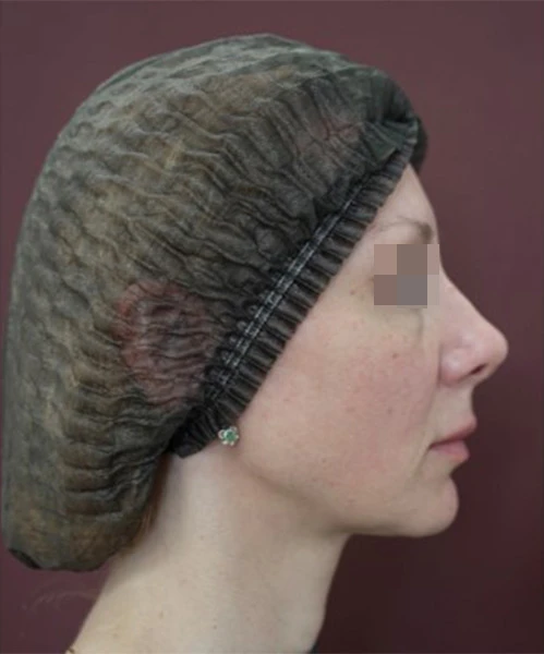 Клинический результат