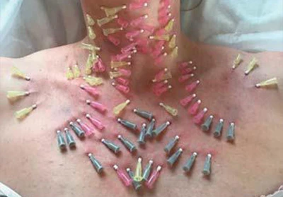 Нити DG-lift 29G