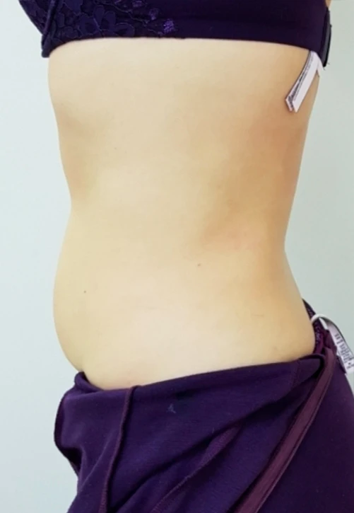 ulfit фото после