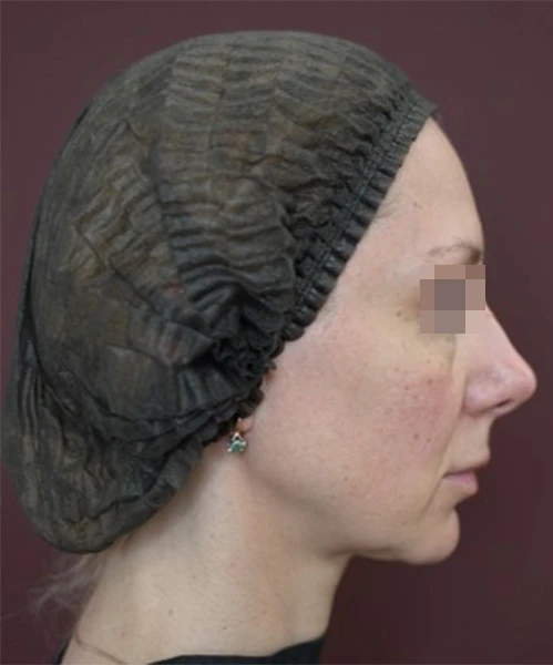 Клинический результат