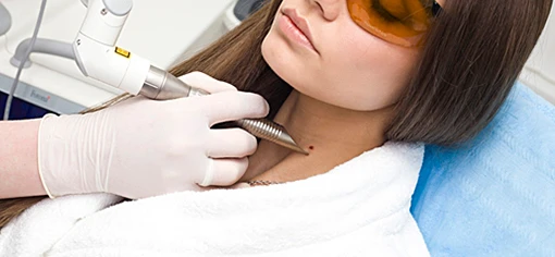 Лазер в косметологии