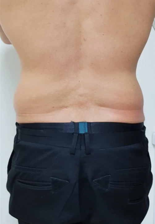 ulfit фото после