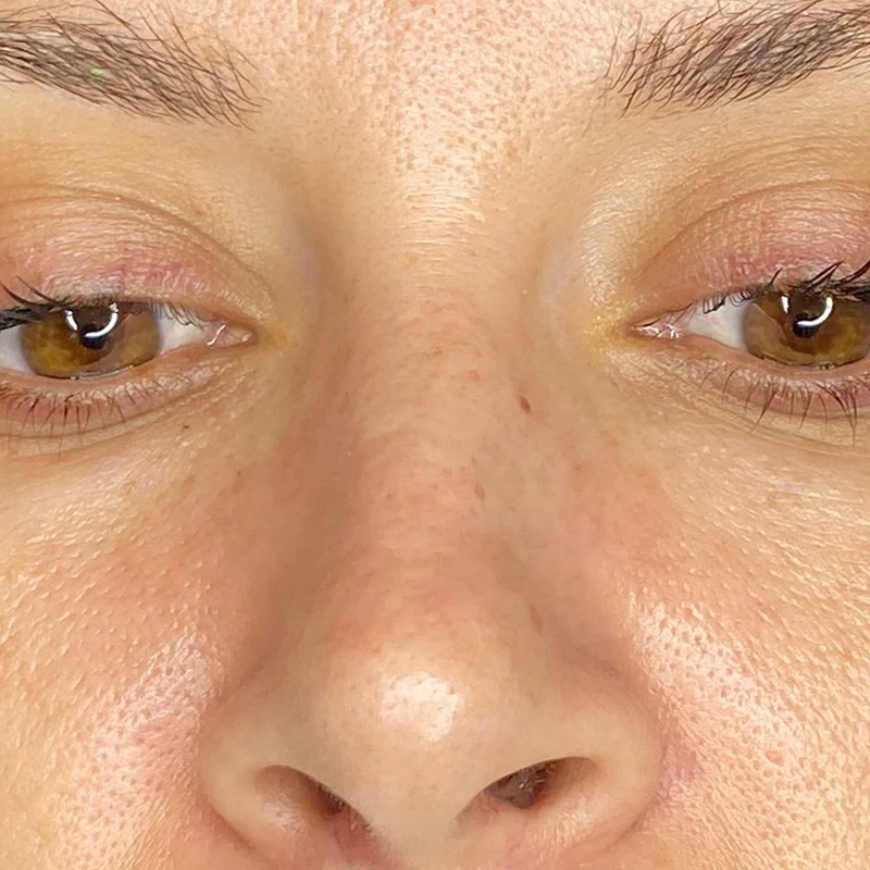 Водородный гидропилинг Hydra Touch H2