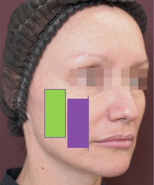 Диагностическая визуализация