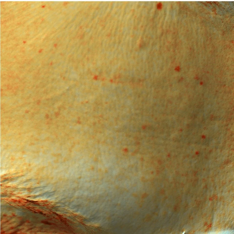 Монотерапия IPL