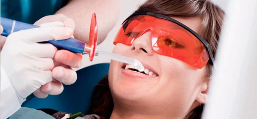 Белоснежная улыбка 