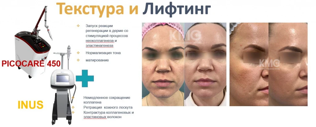 Сочетаемость аппаратных технологий