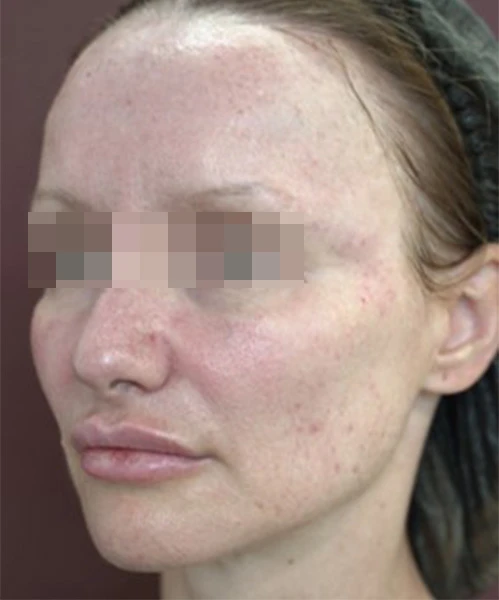 Клинический результат