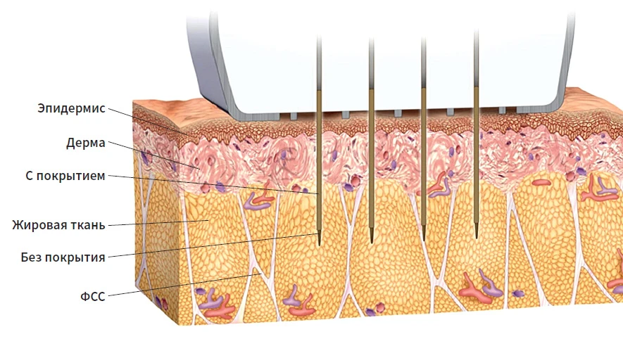 Механизм действия Morpheus 8