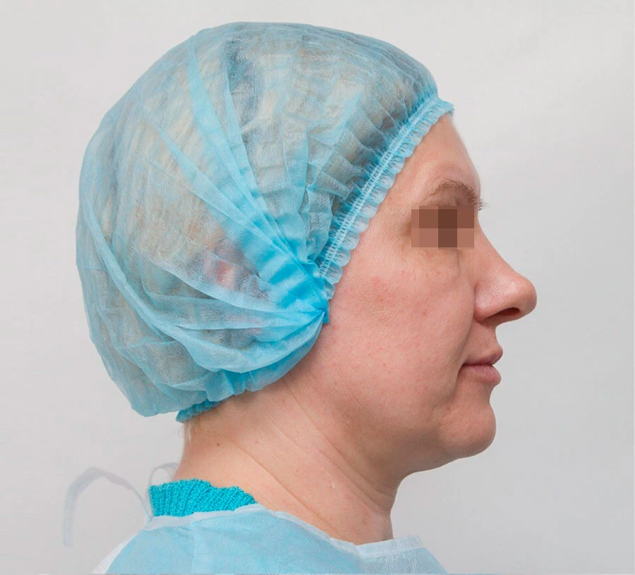 Применение Ultherapy