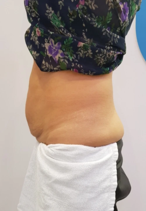 ulfit фото после