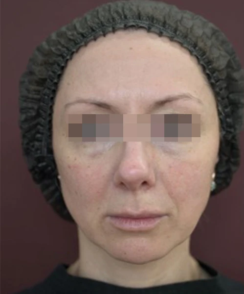 Клинический результат