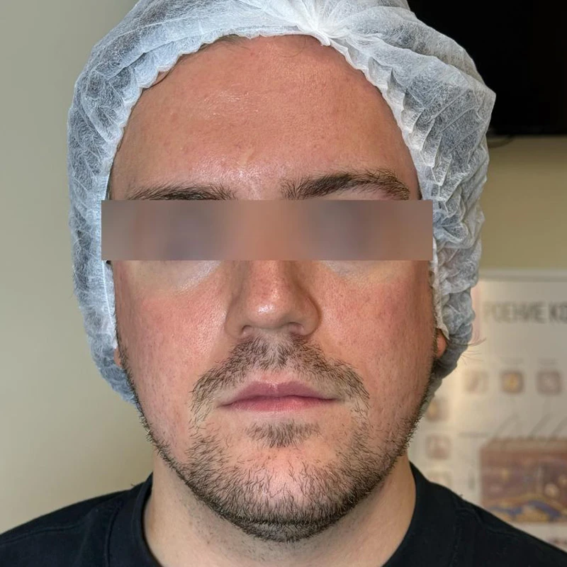 Capello Re:Flex CO₂