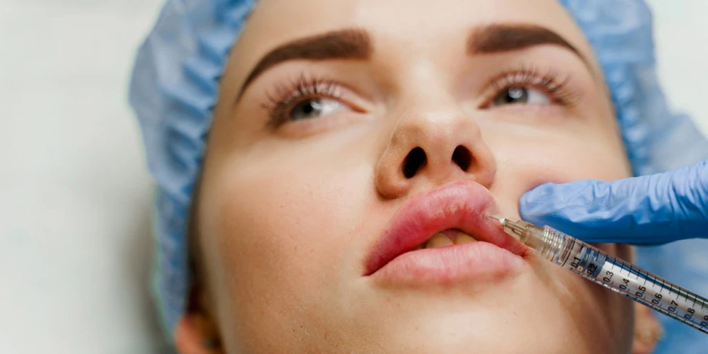Увеличение губ филлерами