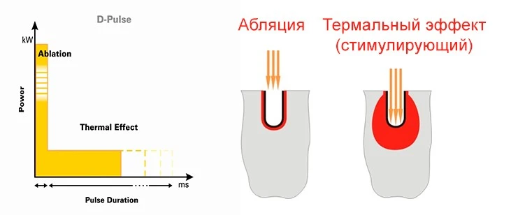 Форма импульса D-Pulse