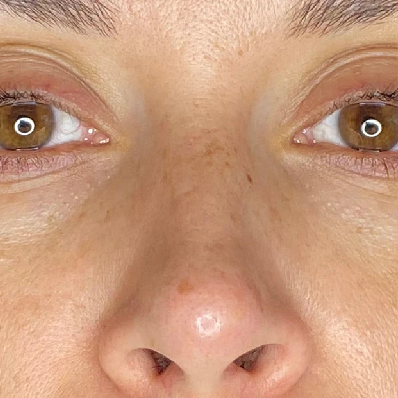 Водородный гидропилинг Hydra Touch H2