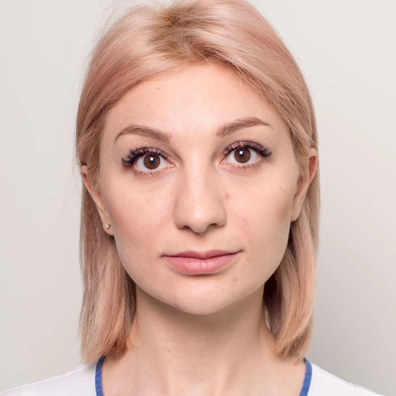 Алла, 32 года. Фото после