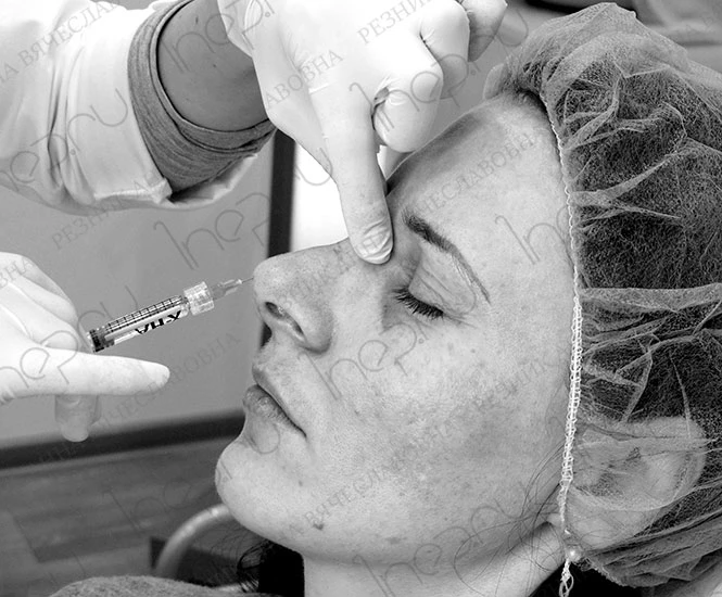 Введение препарата