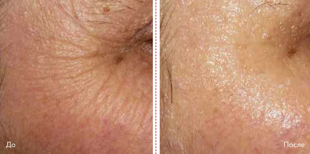 DERMADROP
