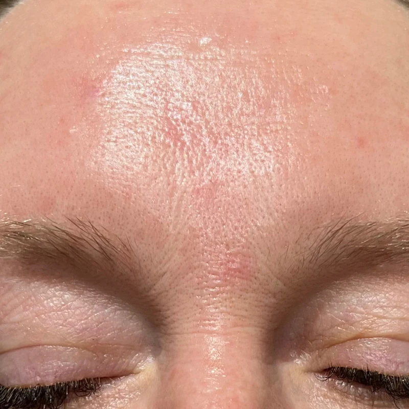 Водородный гидропилинг Hydra Touch H2