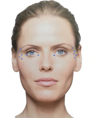 Разведение Ксеомина