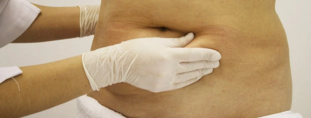 Протокол мезокоррекции локальных жировых отложений