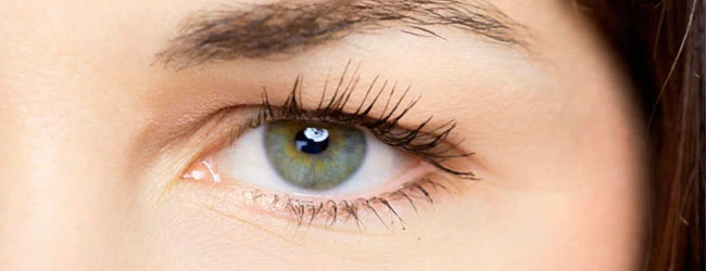 блефароптоз фото